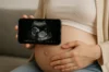 Descubra o melhor app de ultrassom pelo celular! 👶📱