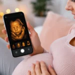 Ultrassom virtual no celular está emocionando pais 👶