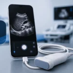 App Grátis para Fazer Ultrassom Online