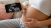 Ultrassom pelo Celular: Como Funciona